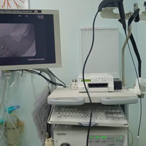 Flexible bronchoscopy