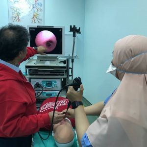 Flexible Bronchoscopy